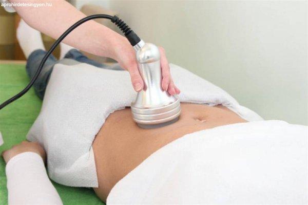 Kavitacios zsírbontás és ránctalanító arfeszesites ultrahang
