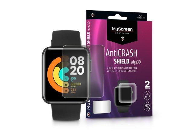 Xiaomi Mi Watch Lite ütésálló képernyővédő fólia - MyScreen Protector
AntiCrash Shield Edge3D - 2 db/csomag - átlátszó