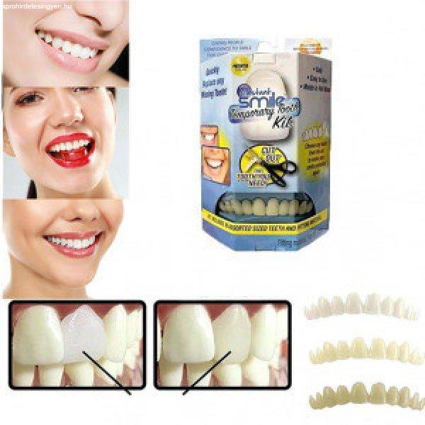 Instant Smile Kit - 30 db Ideiglenes szilikon foghelyettesítő