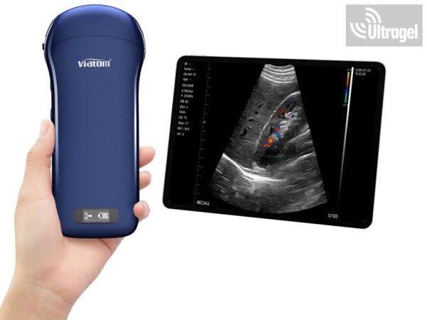 Kézi ultrahang "3in1" color doppler, lineáris,konvex, cardio -
Viatom, Wifi