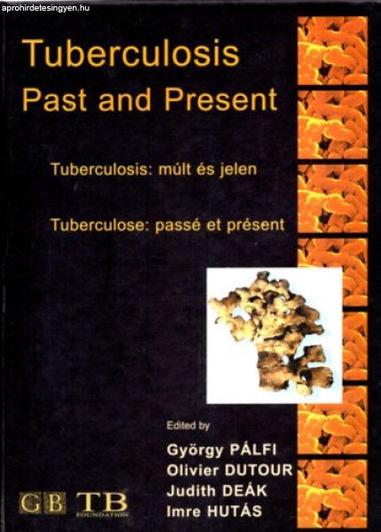 Tuberculosis: múlt és jelen - Past and Present - Passé et present
(többnyelvű) - Olivier-Deák Judit-Hutás Imre Pálfi György-Dutouor