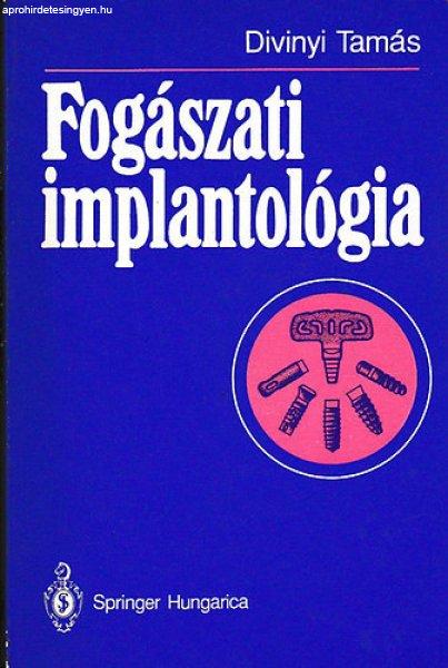 Fogászati implantológia - Divinyi Tamás