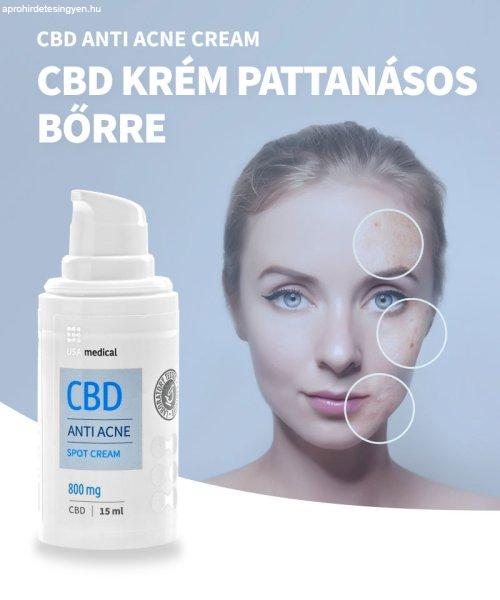 CBD krém pattanásos bőrre  800 mg CBD | 15 ml