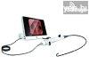 Fiberoszkp Flexibilis Laringszkp - Rhino laryngoscope VISI