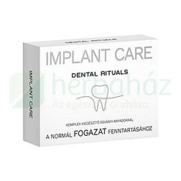 Dental Rituals Implant Care A Fogazat Fenntartásához Tabletta 30Db